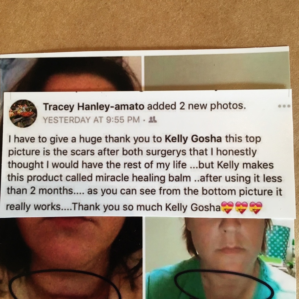 FRESHLY MADE 11/08/2025 🛍❤️MIRACLE HEALING BALM ❤️BEST IN BEAUTY POSH PICK!! - Picture 6 of 14